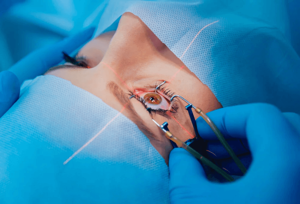 Tratamiento: Microcirugia Ocular — Dr. Carlos Ortega, oftalmólogo en Banfield