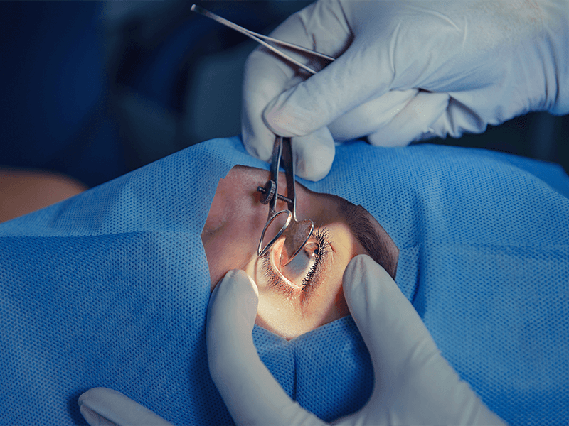 Tratamiento: Cirugía de Retina — Dr. Carlos Ortega, oftalmólogo en Banfield